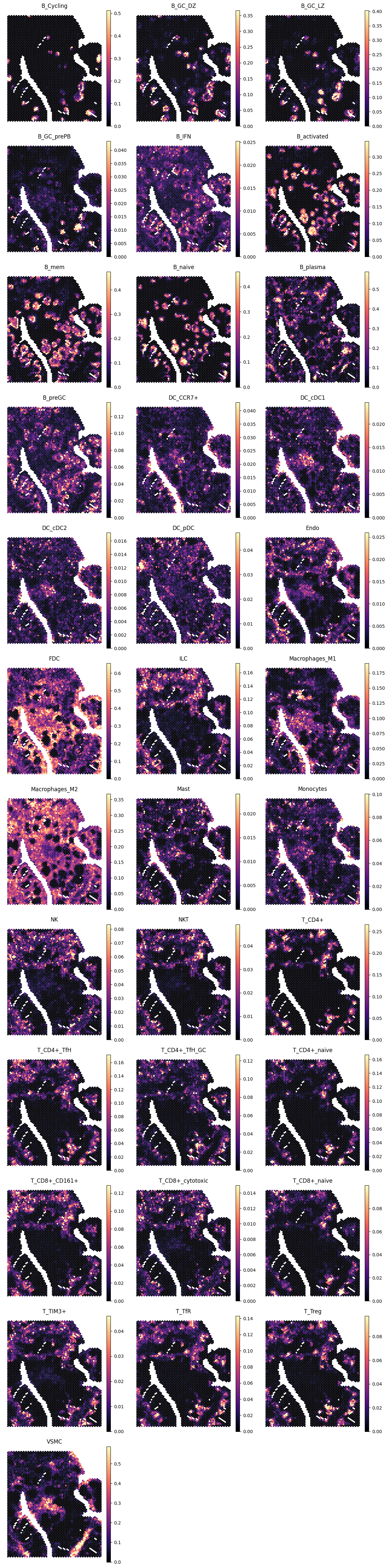 ../_images/tutorials_human_lymphoid_12_0.png