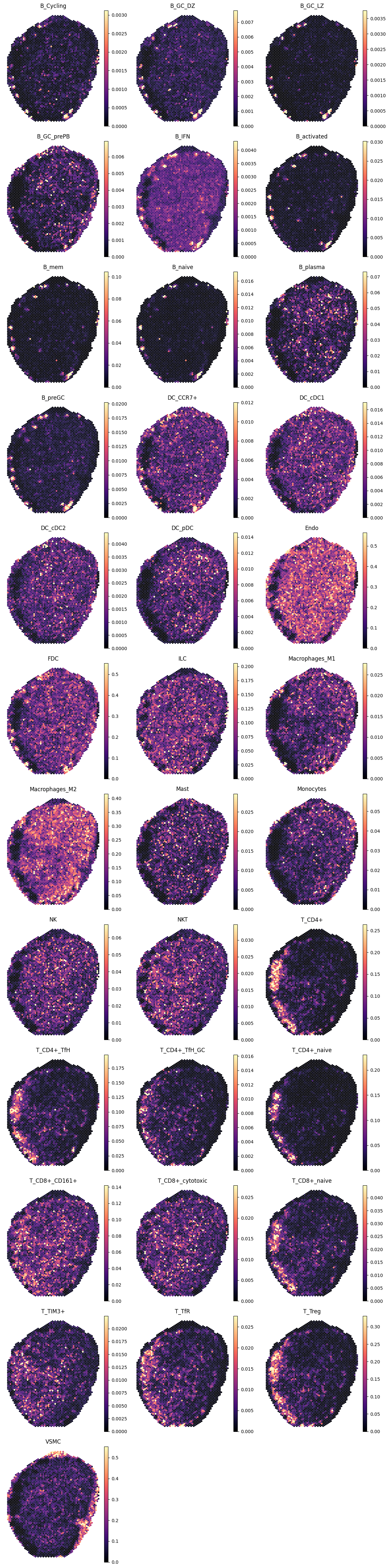 ../_images/tutorials_human_lymphoid_15_0.png